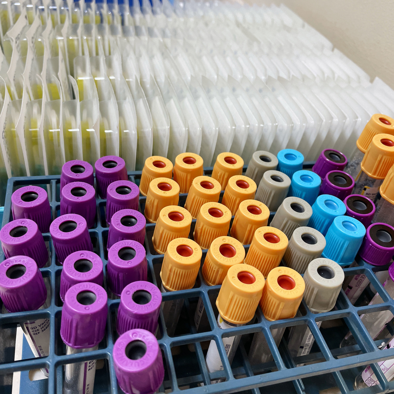 Collection of blood sample tubes